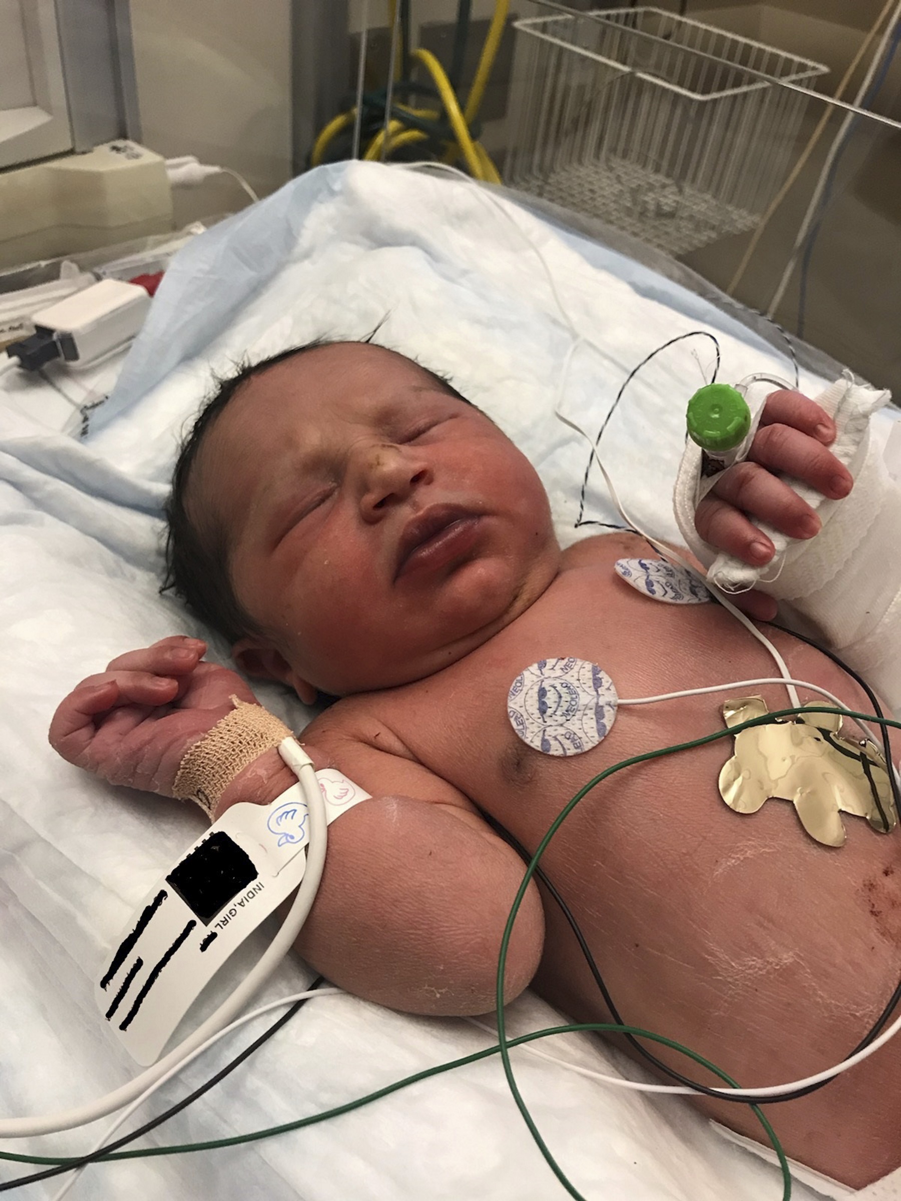 Video Shows Rescue Of Baby From Plastic Bag In Forsyth County Woods