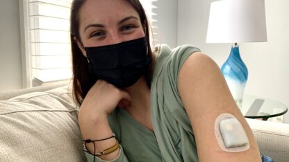 Alina Bills lives with Type 1 diabetes and wears an insulin pump every day to regulate her blood sugar.