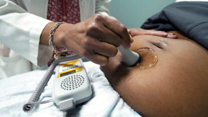 A doctor uses a hand-held Doppler probe on a pregnant woman to measure the heartbeat of the fetus on Dec. 17, 2021, in Jackson, Miss. (AP Photo/Rogelio V. Solis, File)